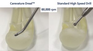 The Shield advantage